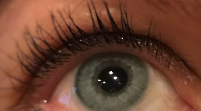 Kontaktlinser – de første dage